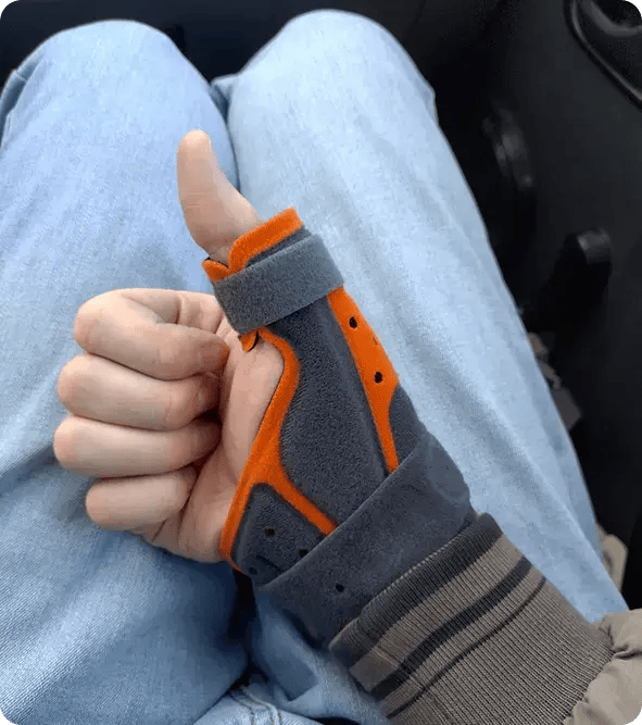 A close-up of a hand wearing a grey and orange medical thumb brace with a "thumbs up" gesture, symbolizing Jango’s support for physical rehabilitation and the use of assistive technology for NDIS participants in Toowoomba.