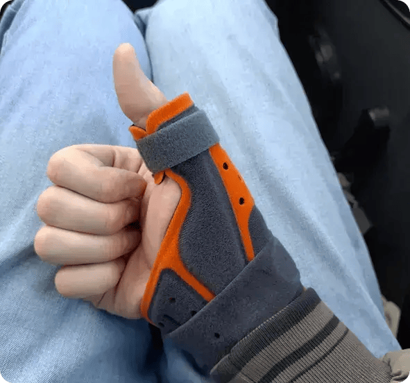 A close-up of a hand wearing a grey and orange medical thumb brace with a "thumbs up" gesture, symbolizing Jango’s support for physical rehabilitation and the use of assistive technology for NDIS participants in Toowoomba.